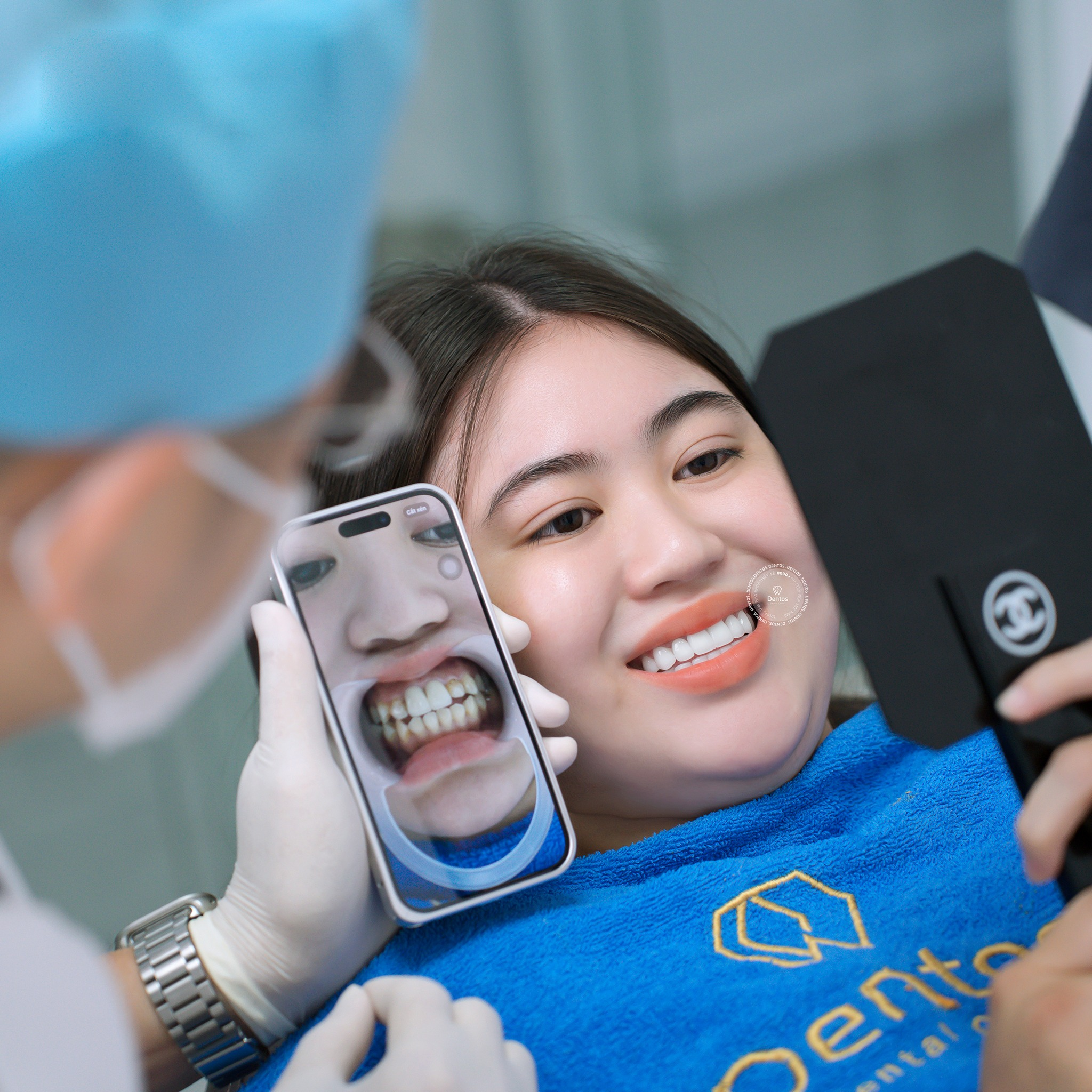 Kết quả nụ cười sau 2 lần hẹn tại nha khoa Dentos